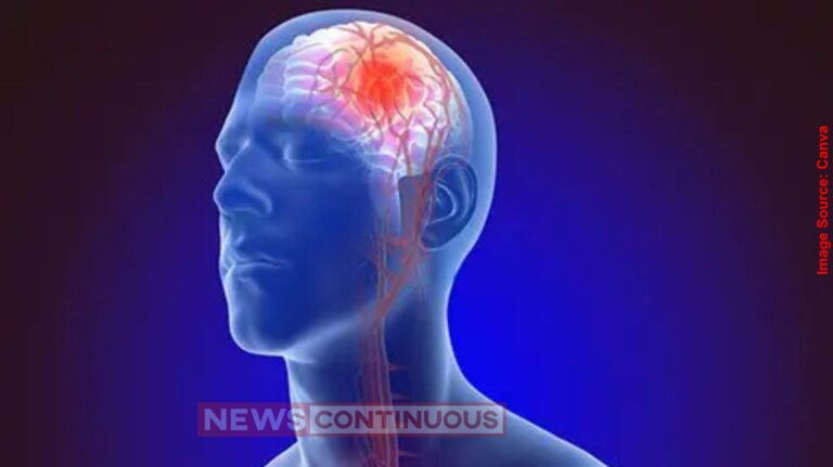 Early Stroke Symptoms સાવધાન! જો સવારે ઉઠતાની સા