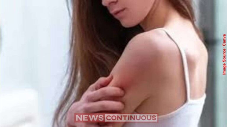 Vitamin Deficiency શરીરમાં વારંવાર ખંજવાળ આવે છે હોઈ શકે છે આ વિટામિન્સની ઉણપ;