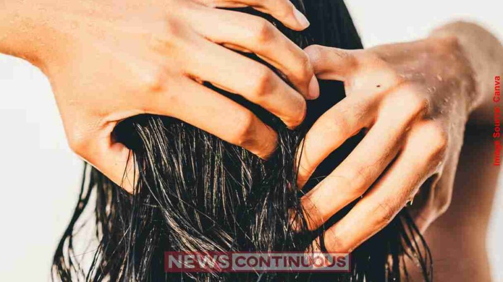 hair washing tips ટાલ પડવાનું મુખ્ય કારણ ક્યાંક તમારું શેમ્પૂ તો નથી ને જાણો વાળ ધોવાની