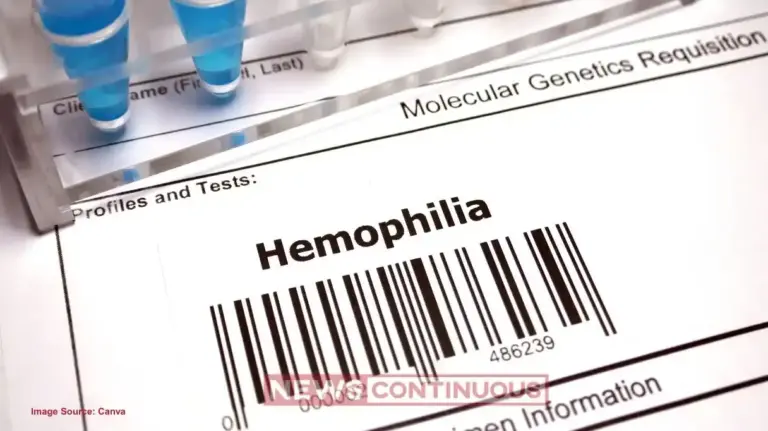Hemophilia। ઈજા નથી થઈ છતાં કેમ પડે છે વાદળી ડાઘ? સાંધાના દુખાવા સાથે જોડાયેલું આ કનેક્શન જાણી તમે પણ ચોંકી જશો.