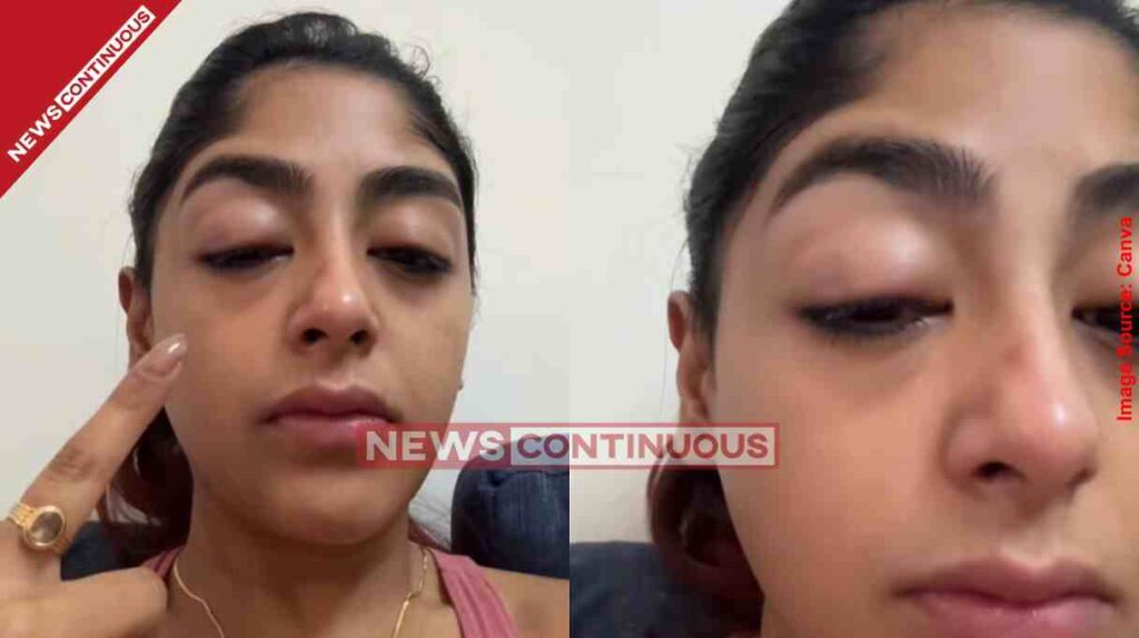 Preet Singh। ક્લબની એ રાત અને અભિનેત્રી પર હુમલો દાંત તૂટ્યો, ચહેરો લોહીલુહાણ; કેમ થઈ હતી આટલી મોટી મારામારી?