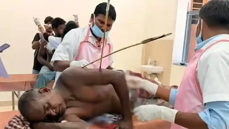 Chaibasa Land Dispute Attack। ઝારખંડમાં જમીન વિવાદે લીધું હિંસક સ્વરૂપ, ૨૦ તીર મારીને શખ્સને લોહીલુહાણ કર્યો; હાથમાંથી આરપાર નીકળ્યું તીર, જાણો હાલની સ્થિતિ