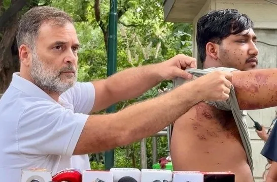 CRPF Pellet Gun Probe  પ્રદર્શનકારીઓ પર પેલેટ ગનનો ઉપયોગ થયો હતો કે નહીં? CRPF આંતરિક તપાસમાં લાગી, રાહુલ ગાંધીએ બતાવ્યા પુરાવા